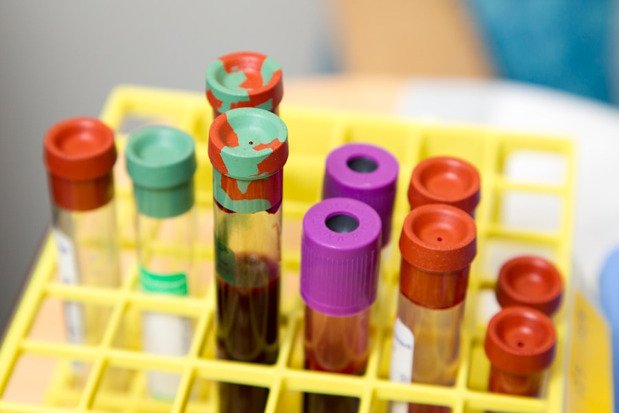 Pathology blood test tubes at Dr. Lal Path Labs Ashok Diagnostic Bankura